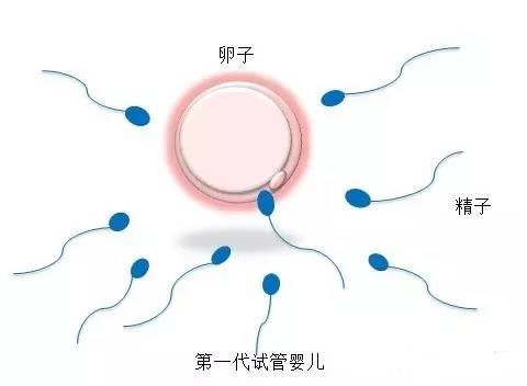 代怀选性别包生男孩